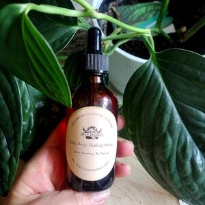 Itchy Scalp Healing Serum, dandruff, dry skin, hair loss